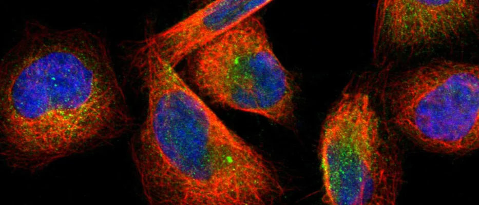 IGF2BP3 expression in cells.